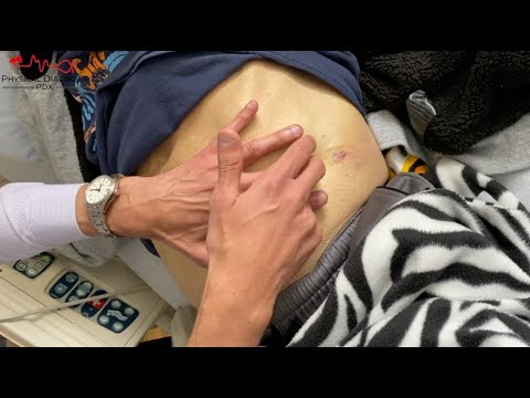 How to Perform Shifting Dullness for Ascites | Technique + Physiology Explained