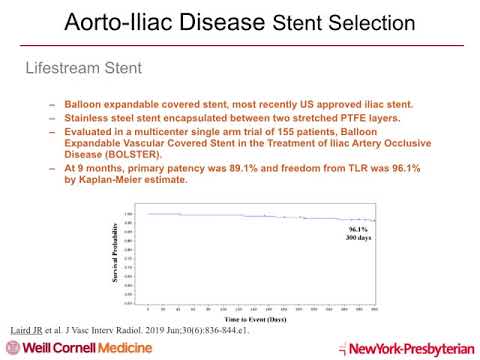 Covered Stents for Aortoiliac Intervention-Dmitriy Feldman, MD