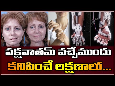 పక్షవాతమ్ వచ్చేముందు కనిపించే లక్షణాలు | Signs and Symptoms of Paralysis | Telugu Mantra Video