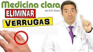 Eliminar verrugas de la piel. Qué no debemos hacer Nunca | Medicina Clara
