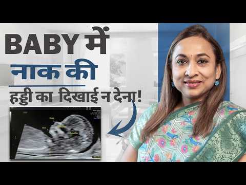 Nasal Bone Missing in Pregnancy Scan What to do if the nasal bone is not visible in the pregnancy...