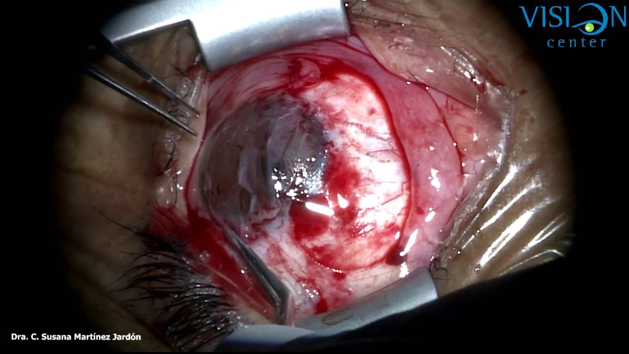 C. Susana Martinez Jardon-20