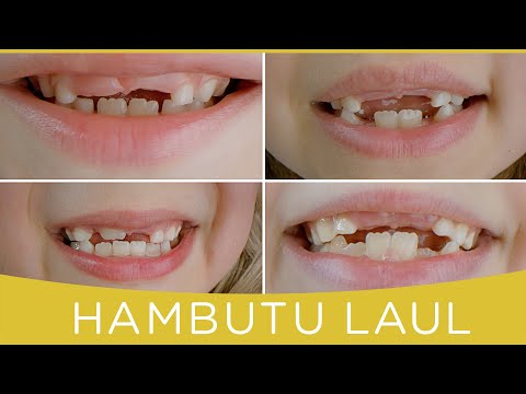 HAMBUTU LAUL - Karoliina Sirendi ja Laulupesa lapsed