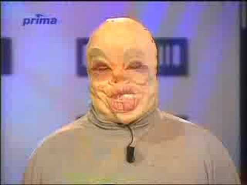 Zdeněk Izer - Metelín - Telebazar (part 2/2)