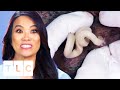 Man Needs "A-cyst-ance" Getting Rid Of Painful Cysts | Dr. Pimple Popper Man Needs "A-cyst-ance" Getting Rid Of Painful Cysts | Dr. Pimple Popper