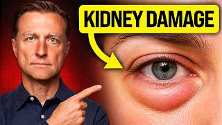 Your Eyes Reveal Kidney Damage Years Before Symptoms