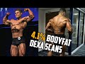This Is What 4.1% Bodyfat Looks like | Multiple DEXA Scans | Wesley Vissers