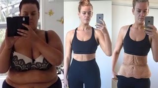 Extreme slimmer posts picture of her loose skin and stretch marks to silence critics