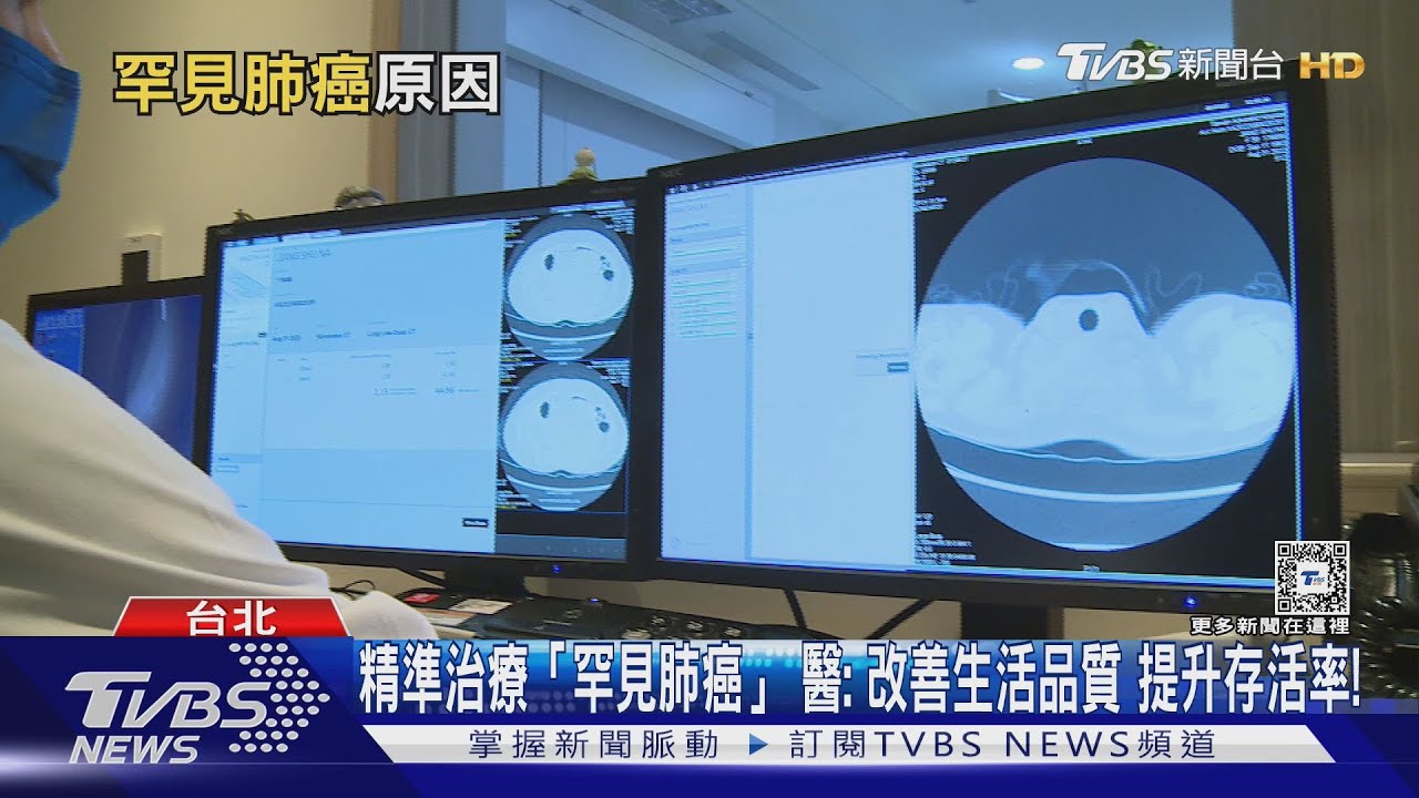 罹「這癌」初期症狀不明顯發現已晚期　醫師：積極健檢不可忽視！