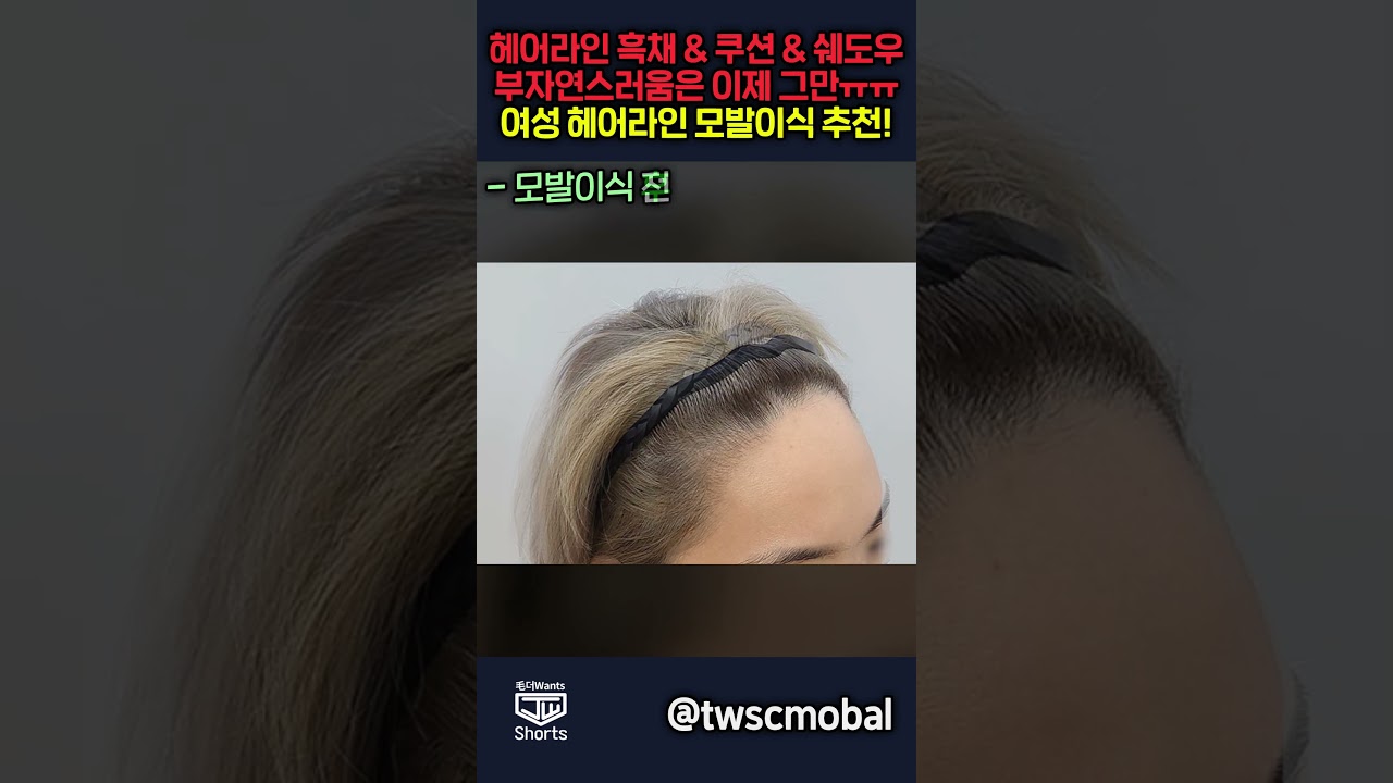 더원츠의원 숏폼