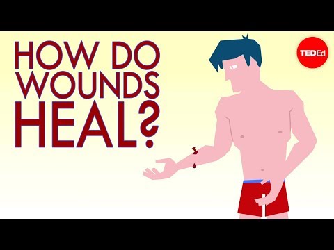 How Do Wounds Heal?