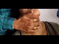 Neck Adam S Apple Massaj ASMR For Healthy Neck