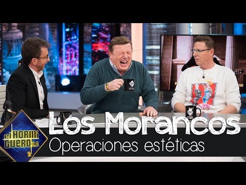 Los Morancos y Pablo Motos se confiesan sobre operaciones estéticas - El Hormiguero 3.0