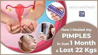 How I Healed my PIMPLES in Just 1 Month & Lost 22 Kgs