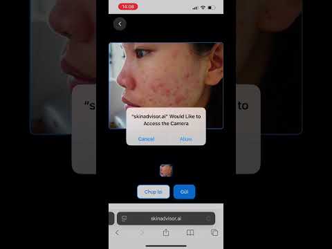 SkinAdvisor AI Demo Video