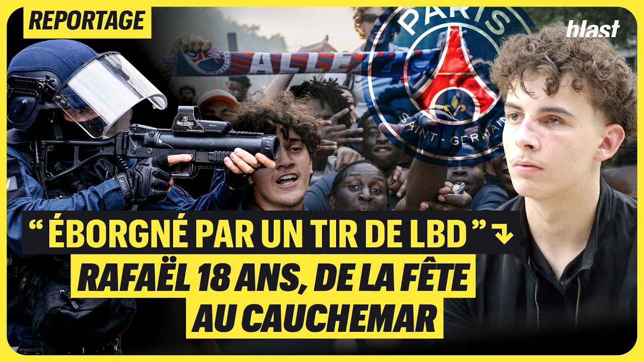 Illustration: Un jeune de 18 ans perd un œil après un tir de LBD lors de la fête du PSG