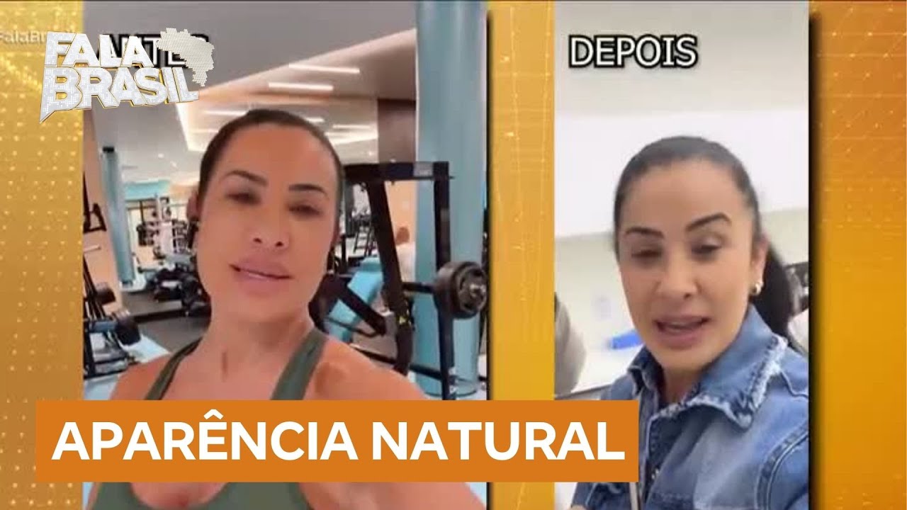 Celebridades removem preenchimentos para voltar à aparência mais natural