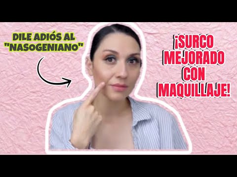 COMO DISIMULAR EL SURCO NASOGENIANO-Bren EsAv