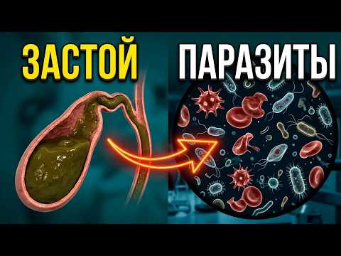 Olga Shishova warns: bile is the body's chief sanitizer, and stagnation is dangerous