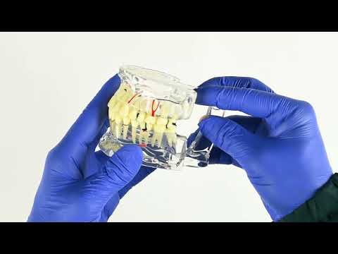 iDENTical Adult Pathologies Model M4001-1
