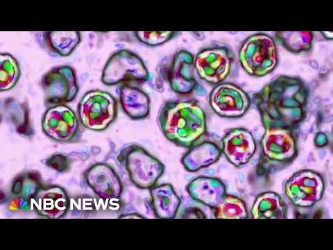 Pennsylvania reports fourth death linked to measles