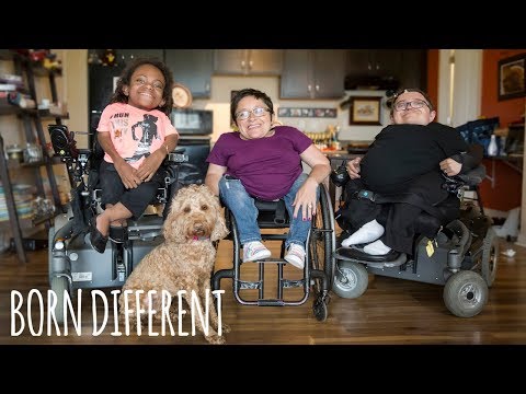 The Family ‘Made Of Glass’ Have Broken 600 Bones | BORN DIFFERENT
