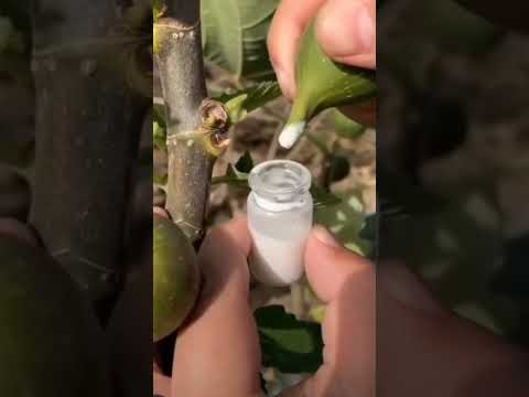 vitiligo best treatment