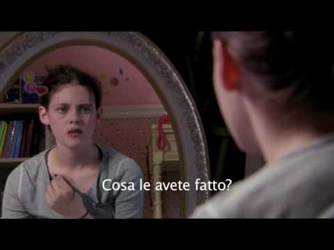 Osteocondrosi del trattamento braccio spalla X-ray del tasso polso