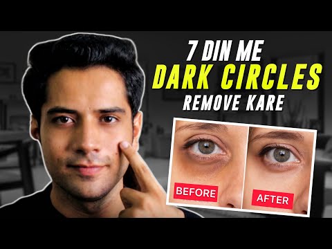 how to remove dark circles | how to remove dark circles under eyes at home| Dark spots from face