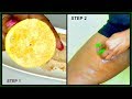 HOW TO GET RID OF DARK INNER THIGHS HOW TO CLEAR DARK INNER THIGHS FAST Khichi Beauty