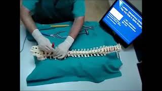 Colocacion de un sistema dinamico en region Lumbar U