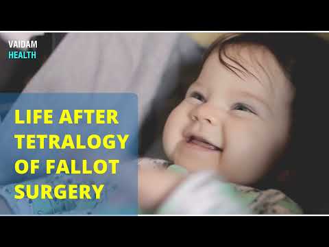 Life after Tetralogy of Fallot Surgery