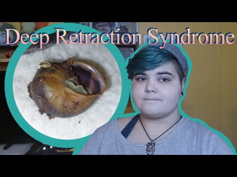 Deep Retraction Syndrome In Garden Snails