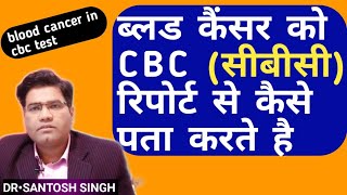 ब्लड कैंसर को cbc टेस्ट से कैसे पता करते है | cbc test result in blood cancer | blood cancer tests | DOWNLOAD THIS VIDEO IN MP3, M4A, WEBM, MP4, 3GP ETC