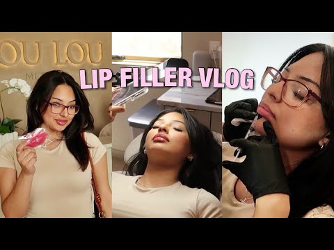VLOG| Getting Lip Filler For The First Time!!