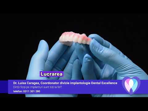 Dinții ficși pe implanturi...