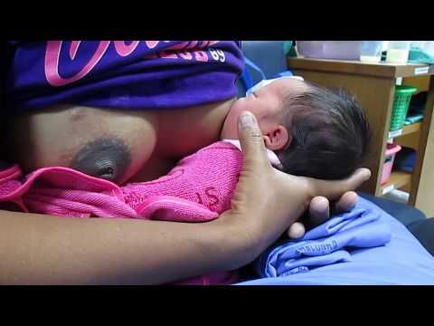 ความสามัคคีหน้าอกรูปร่างครีม ราคาของการผ่าตัดเสริมเต้านม