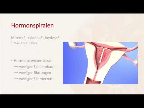 Hormonspirale (Mirena, Kyleena, Jaydess) zur Verhütung - Frauenarztpraxis am Potsdamer Platz