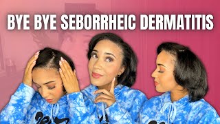 How to Get Rid of Seborrheic Dermatitis | ♡ Healthy Relaxed Hair
