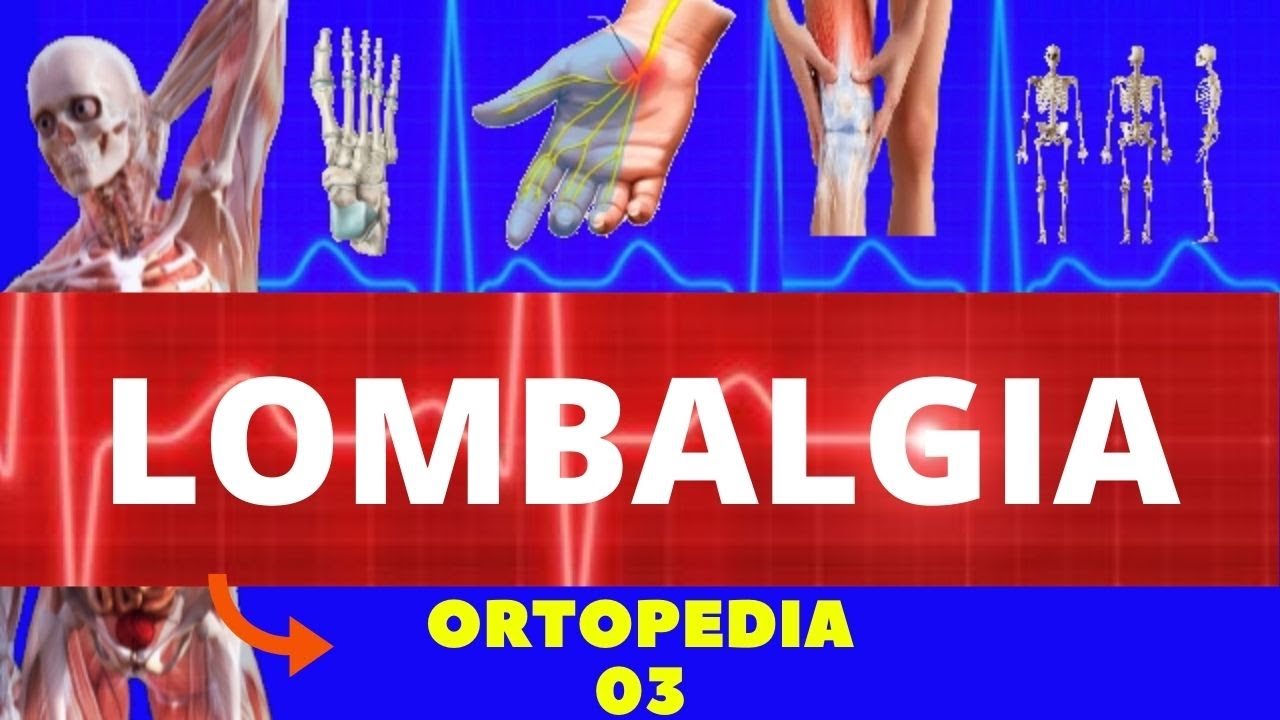 LOMBALGIA (CAUSAS, SINTOMAS, DIAGNÓSTICO E TRATAMENTO) - DOR NA COLUNA