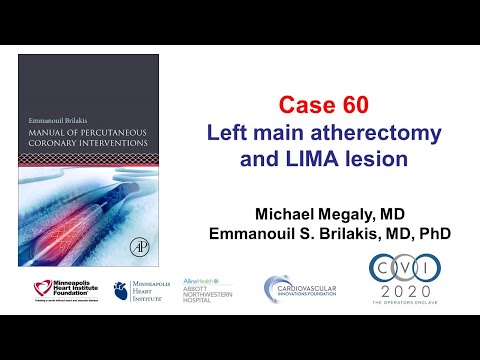 Case 60: PCI Manual - Left main and LIMA PCI in a prior CABG patient