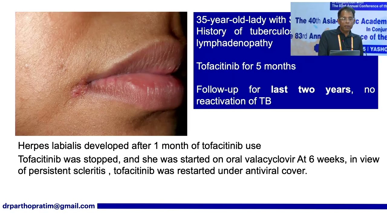 Taking on the Challenges Jak Inhibitors to the Resque