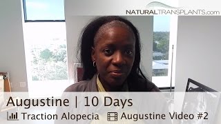 Thinning Hair Women | Hair Loss Cure | 10 Day Followup (Augustine)