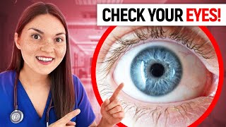 What Your EYES Say About your HEALTH: Doctor Explains