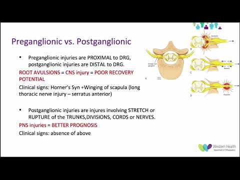 OrthoFracs - Brachial Plexus Injuries by Dr. Lily Salehi