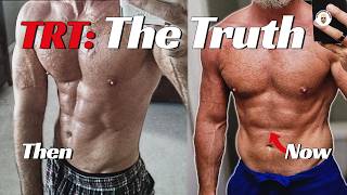 Trt: The Ugly Truth They Didn't Tell Me About Testosterone Replacement Therapy