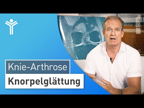 Knorpelschaden am Knie: Wann macht die Knorpelglättung Sinn?