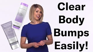 How To Get Rid Of Hard Red Clogged Body Bumps | Paula