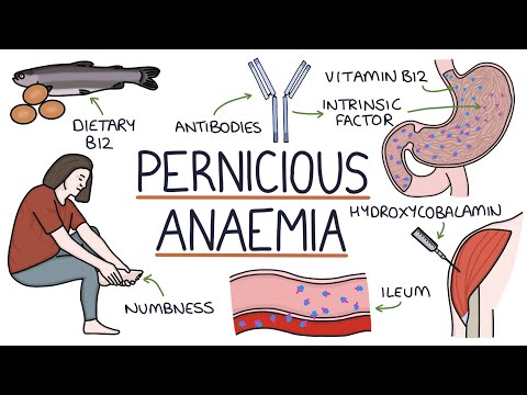 Understanding Pernicious Anaemia (B12 Deficiency)