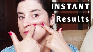How To Get Rid Of Laugh Lines (Nasolabial Folds) Naturally At Home！ |Rachna Jintaa